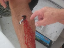 Ouch, spearfishing gone wrong